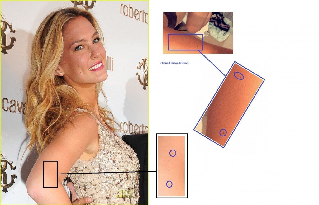 Bar-Refaeli-Photo-Proofs-Taches de rousseur sur le bras